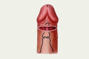 kako da poveća penis
